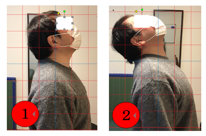 首　肩コリ　の　ビフォア・アフター